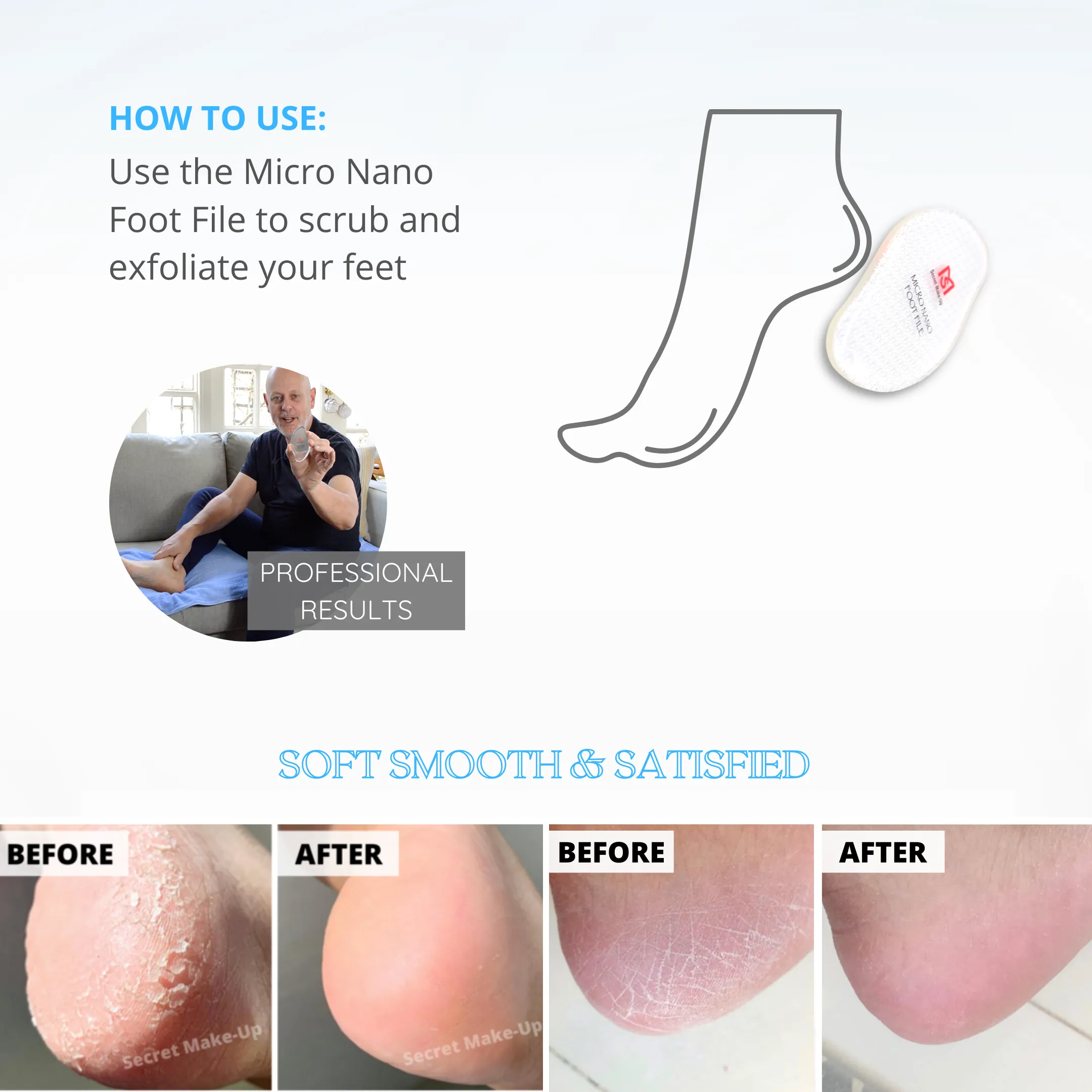 Micro Foot File